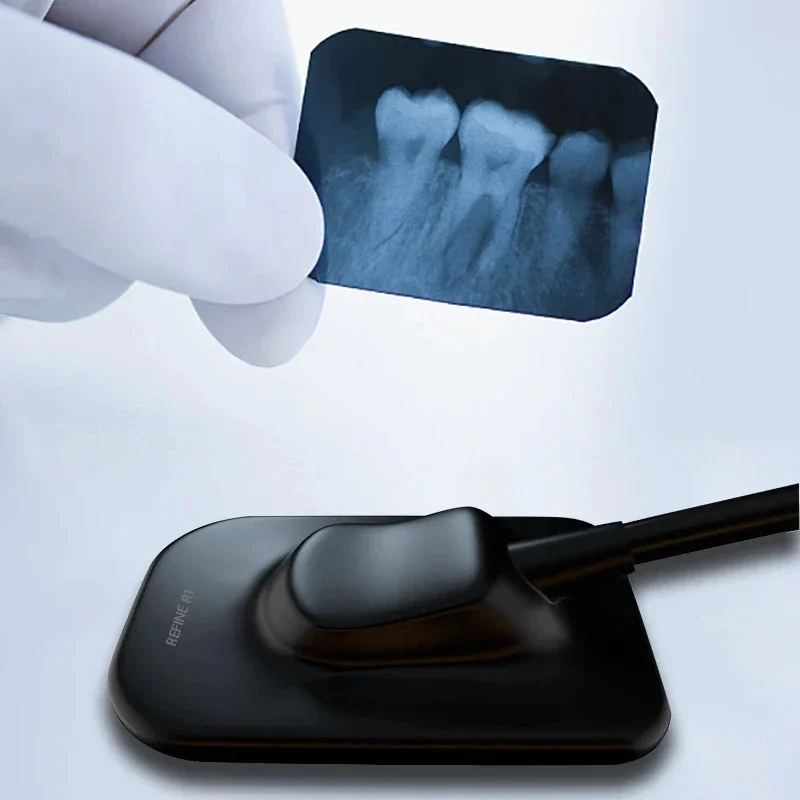 Refine Sensor Exceptional Images to Dentists for Precise Diagnosis Effective Planning of Patient Treatment improving efficiency