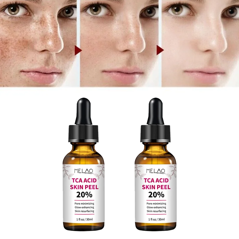 เซรั่ม30Ml Hyaluronic 20% TCA Acid Skin Care Peel 2% Salicylic Acid & Hydroxyethylcellulose สำหรับปรับปรุงหด