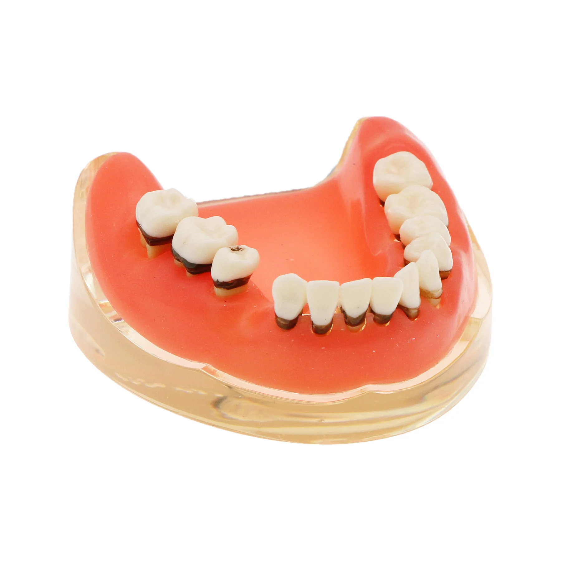 Рисунок 6 - M4017 Модель зубов патологической