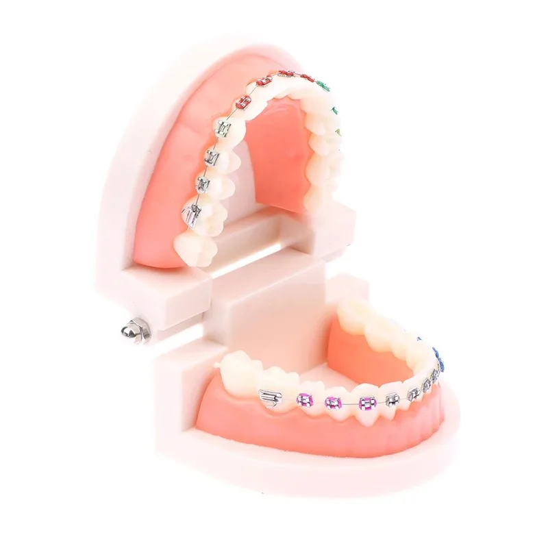 Modelo de tratamiento Dental de ortodoncia, modelo de dientes Typodont para enseñanza, estudio, soportes de Metal/cerámica, lazos de ligadura de alambre de arco, 1 unidad