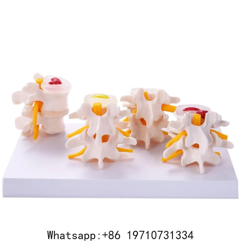 Human Anatomy Skeleton Spine 4-Stages Lumbar Vertebral Model Brain Skull Traumatic Teaching Supplies