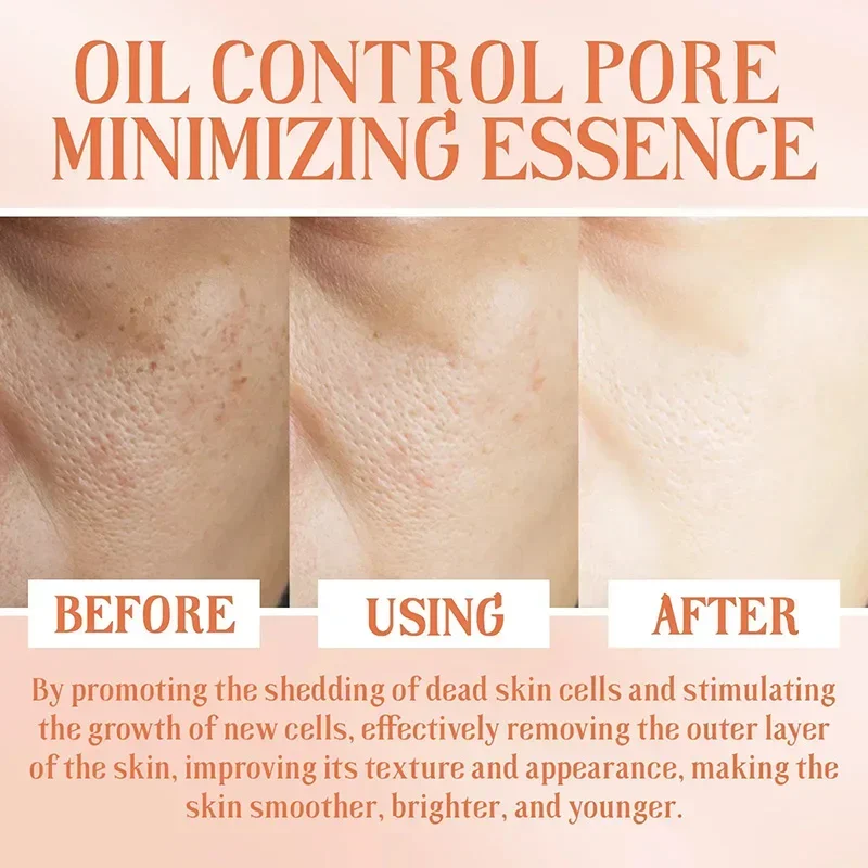 Pore Shrinking Serum Removing Large Pores Face Tightening Repairing Facial Pore Minimizing Get Rid Acne Marks Beauty Cosmetics