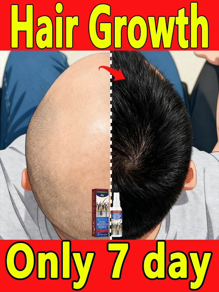 Nᴏ-Rɪɴsᴇ Sᴄᴀʟᴘ Nᴏᴜʀɪsʜɪɴɢ Mɪsᴛ - Bᴏᴏsᴛ Hᴀɪʀ Fᴜʟʟɴᴇss, Rᴇᴅᴜᴄᴇ Sʜᴇᴅᴅɪɴɢ, Qᴜɪᴄᴋ Dᴀɪʟʏ Cᴀʀᴇ