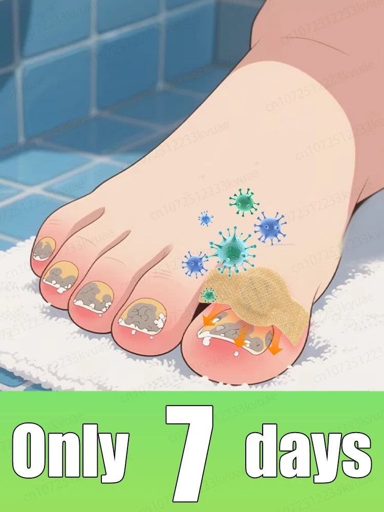 

Don't let ⁿᵃⁱˡ ᶠᵘⁿᵍᵘˢ affect your life. Say goodbye to onychomycosis in 7 days.