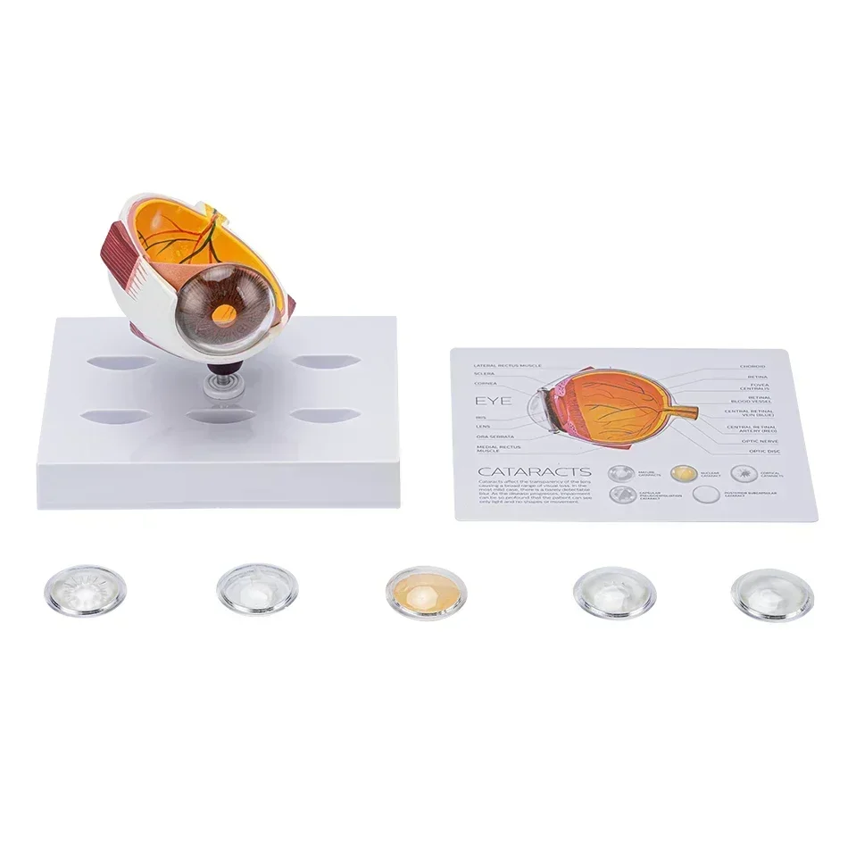 Cornea Eyeball Model Human Eye Model Human Eye Demonstration Teaching Cataract Anatomy Medical  fast shipping