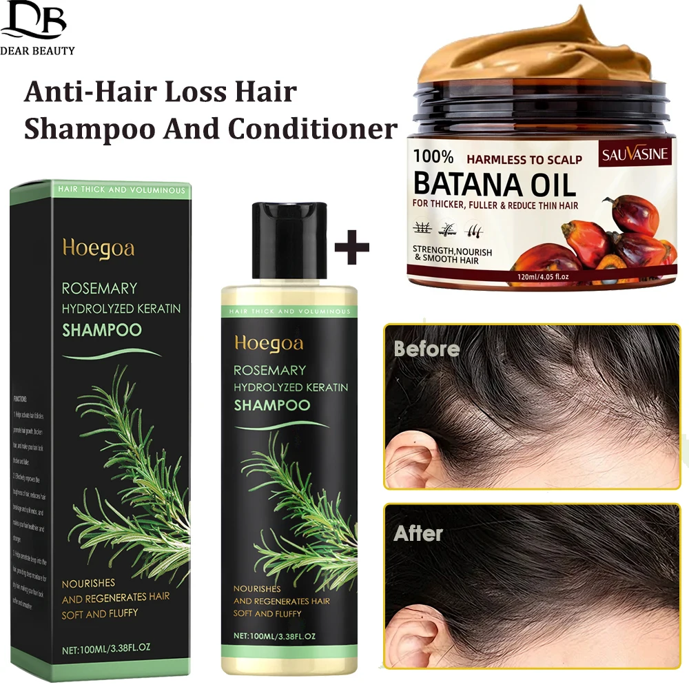 Anti-Hair Loss Hair Shampoo And Conditioner Set Hydrolyzed Keratin Hair Growth Shampoo Repair Dense Batana Oil Conditioner