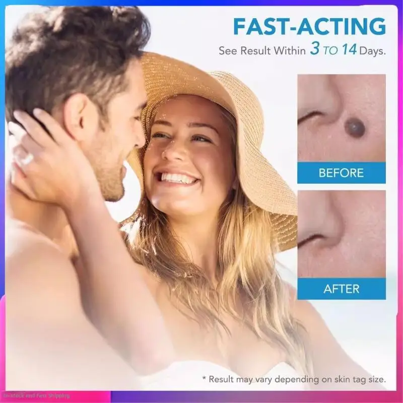 Tweekoppige Wratten Verwijderen Pen Set Auto Skin Tag Remover Pijnloos Mol Wratten Remover Skin Tag Removal Kit Huidverzorging Schoonheid Tool
