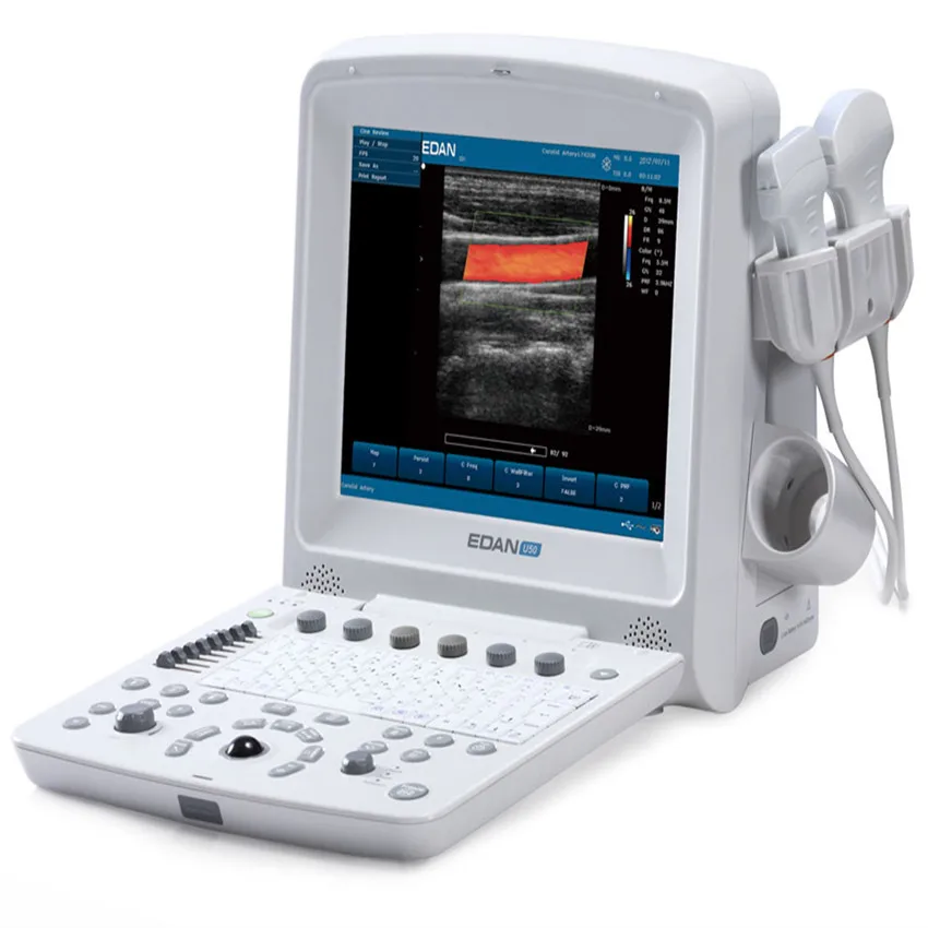 Factory price  EDAN Portable Ultrasound Machine EDAN U50