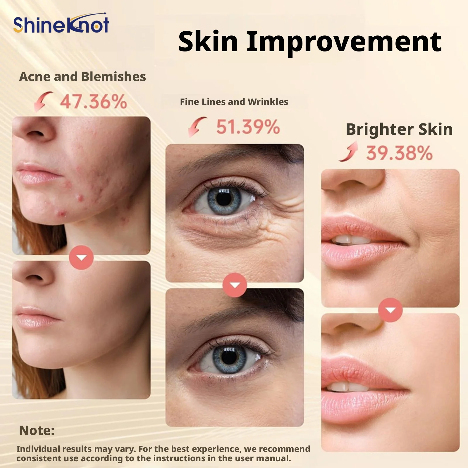 Picture 6: SHINEKNOT Red Light Beauty Device LED Rechargeable Color Light Band Switchable Silicone Infrared Mask Skin Rejuvenation Therapy