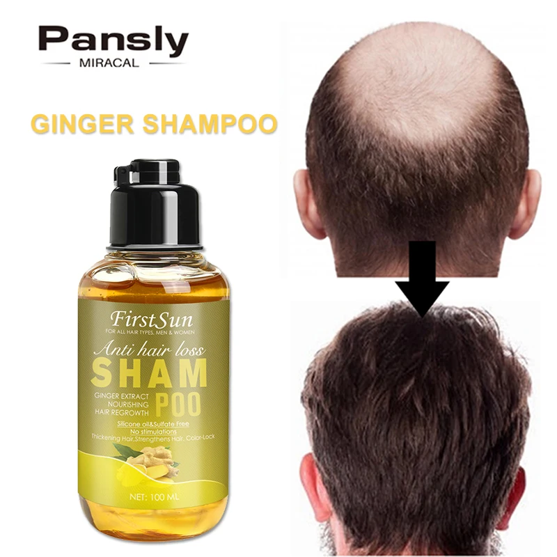 

Genuine Professional Hair Ginger Shampoo Hair Regrowth Fast Thicker Repair Hair RootHair Growth Shampoo Anti Hair Loss Product