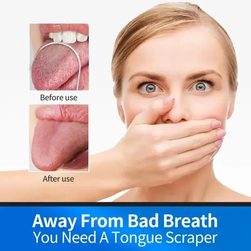 U รูปร่างเครื่องขูดลิ้นเครื่องมือดูแลช่องปากสแตนเลสทําความสะอาดปากทําความสะอาดแปรงลิ้น Bad Breath ลิ้นทําความสะอาดลิ้น