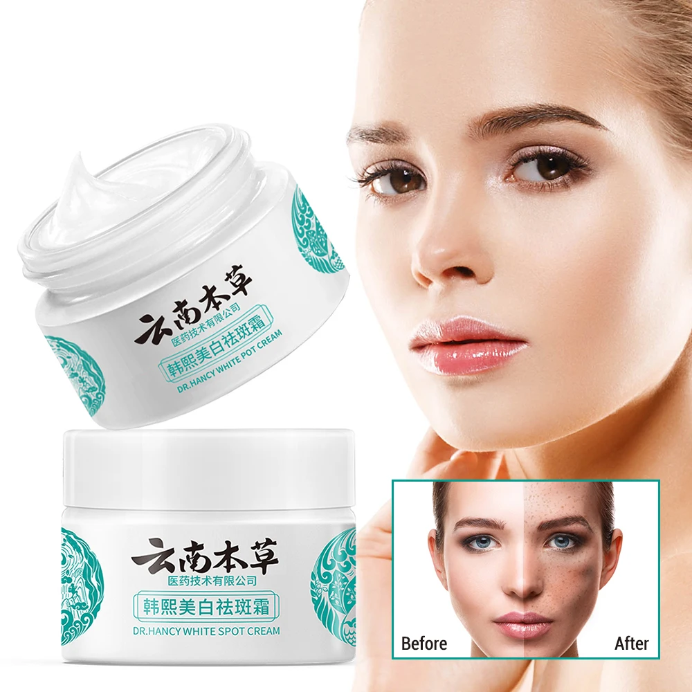 Whitening Spot Lightening Cream Yunnan Herbal Freckle-Removing Cream for Improve Dullness Brighten Skin Fade Melasma Skin Care