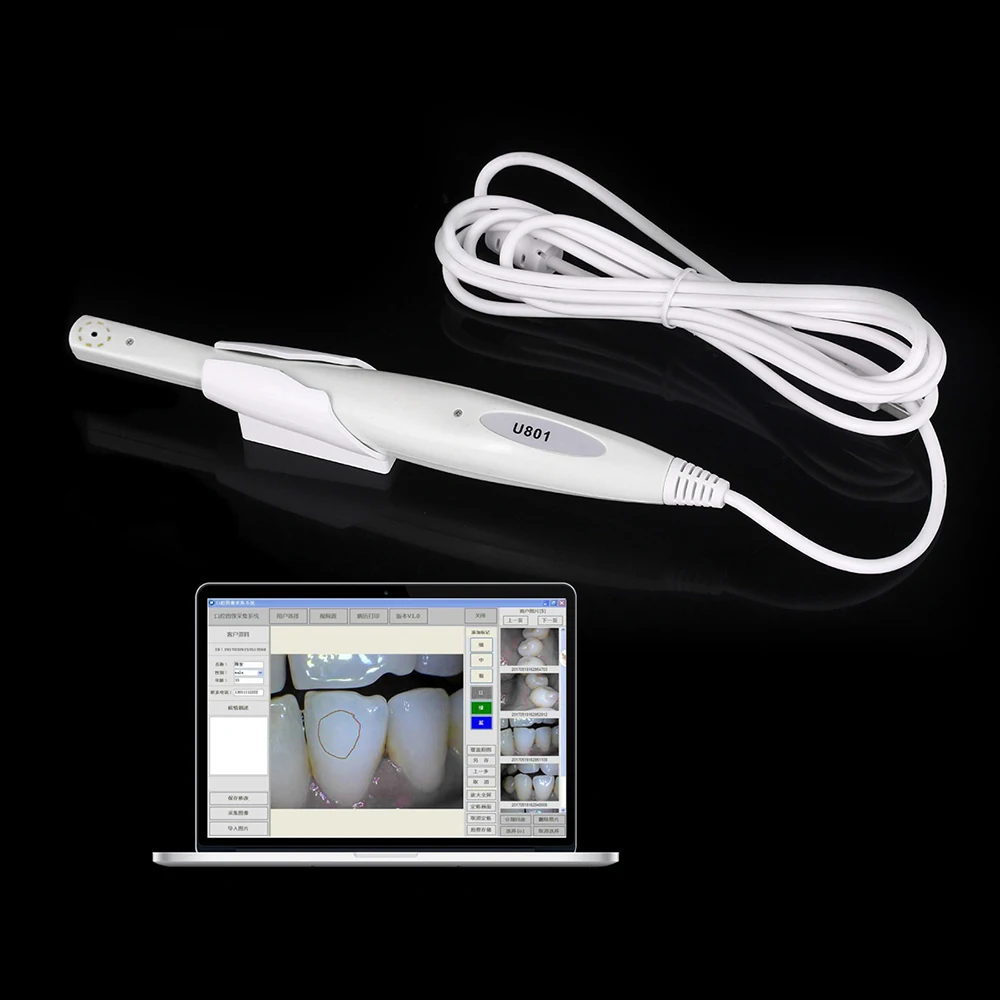 Endoscopio Dental Intraoral Camara inspección Oral impermeable para computadora USB luz LED