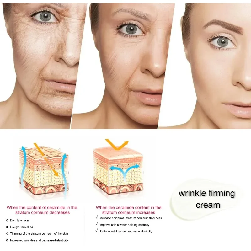 주름 제거 리프트 퍼밍 페이스 크림, 잔주름 미백, 모이스처라이징, 안티에이징, 브라이트닝, 페이셜 스킨 케어 화장품