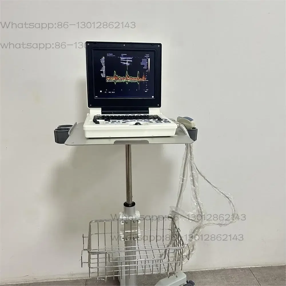 

Scanner à ultrasons vétérinaire | Machine portative de diagnostic animale de haute précision