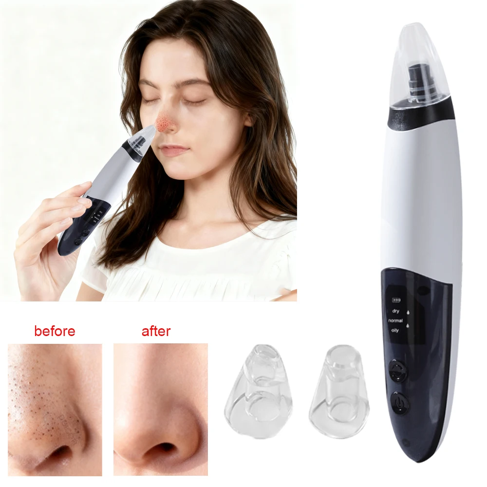 مزيل الرؤوس السوداء الكهربائية مزيل الرؤوس السوداء النقاط السوداء تنظيف عميق للوجه مستخرج الرؤوس السوداء المسام حب الشباب بقعة إزالة الفراغ