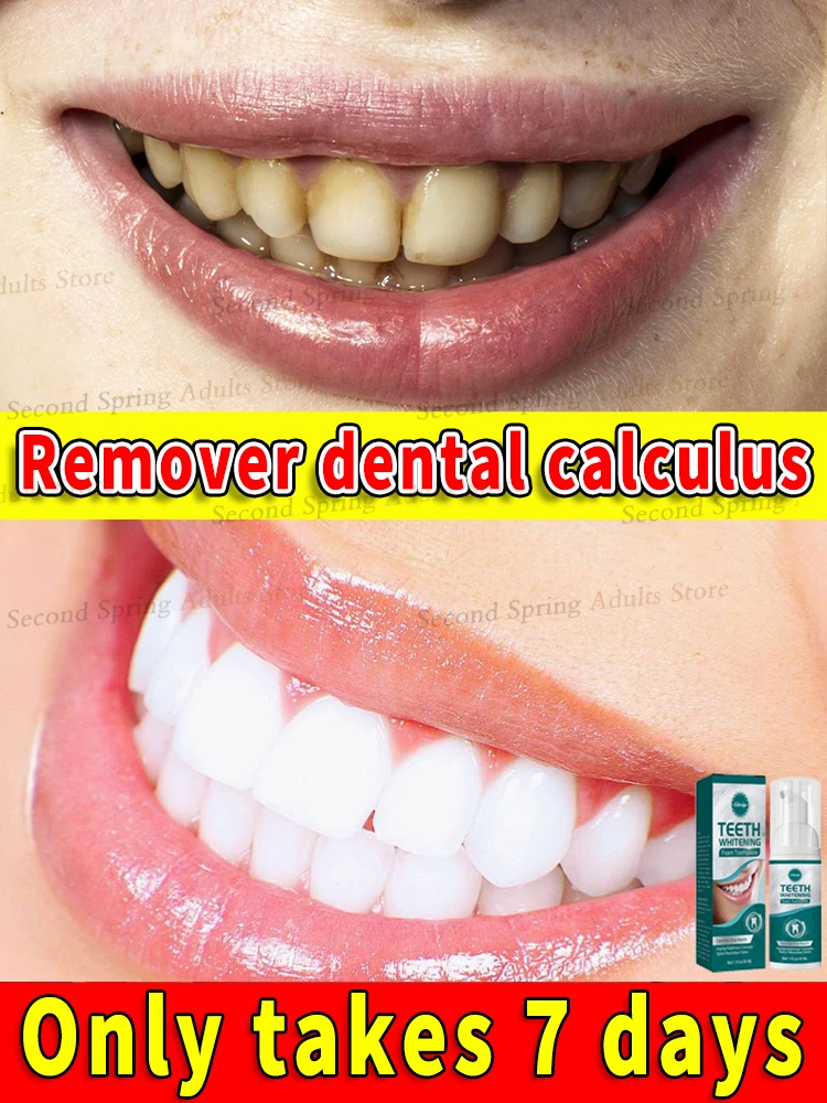 2025 Hot Products Teeth Whitening Mousse Removes Plaque and Stains Deep Cleans Fresh Breath Oral Hygiene Dental Tools