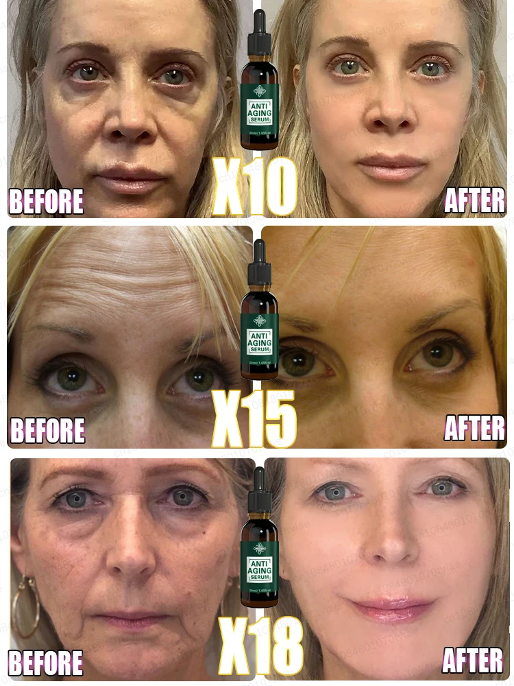 2025年ベストセラー すべてのしわが消える