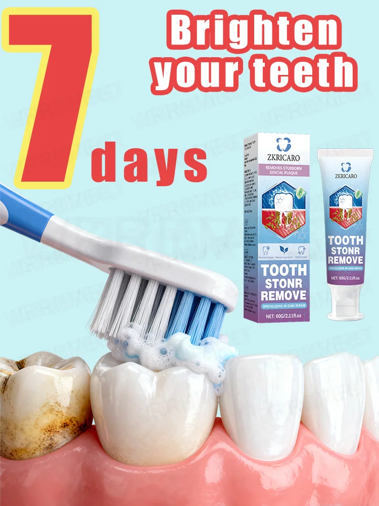 

Отбеливающая зубная паста делает ваши зубы ярко-белая. Сияющие зубы освещают свою красоту