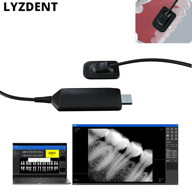 Big Size Digital Cameras Dental X-Ray Sensor High-Frequency Rx Digital Intraoral Digital System H D Image Radiovisografo Tools