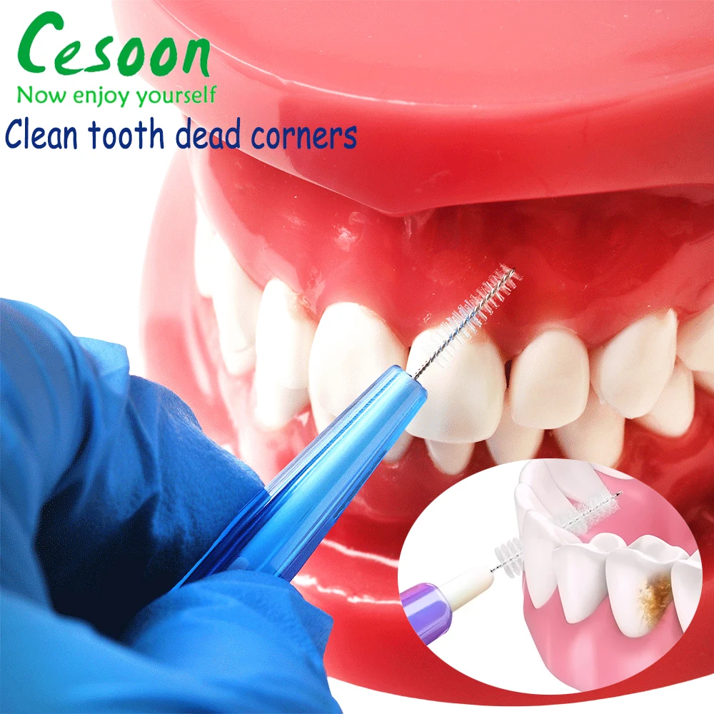 10Pcs Dental Interdental Brushes Tooth Cleaning Brush Orthodontics 0.6mm 0.7mm 0.8mm 1.0mm Cleaning Stains For Braces Dentist