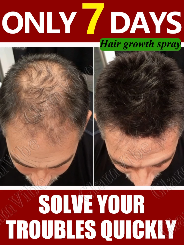 

Hᴀɪʀ sᴘʀᴀʏ: the secret to controlling ʏᴏᴜʀ ʜᴀɪʀ.