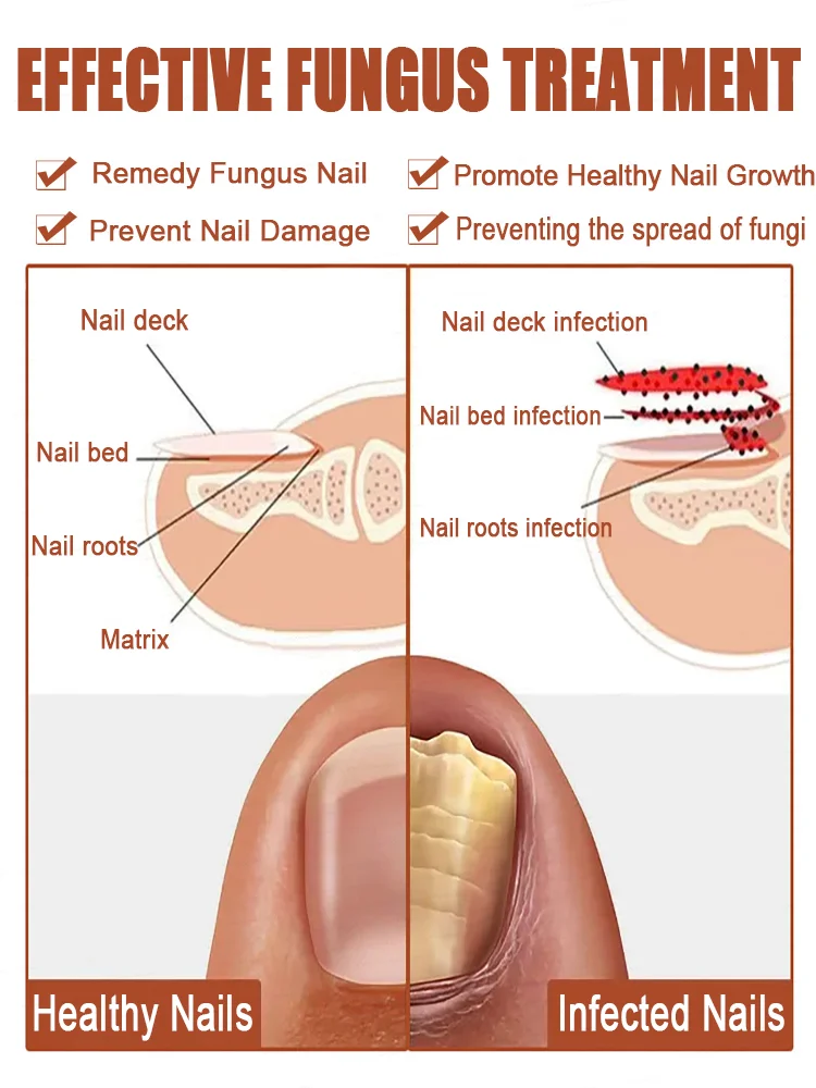 Restore your nails to their perfect moment