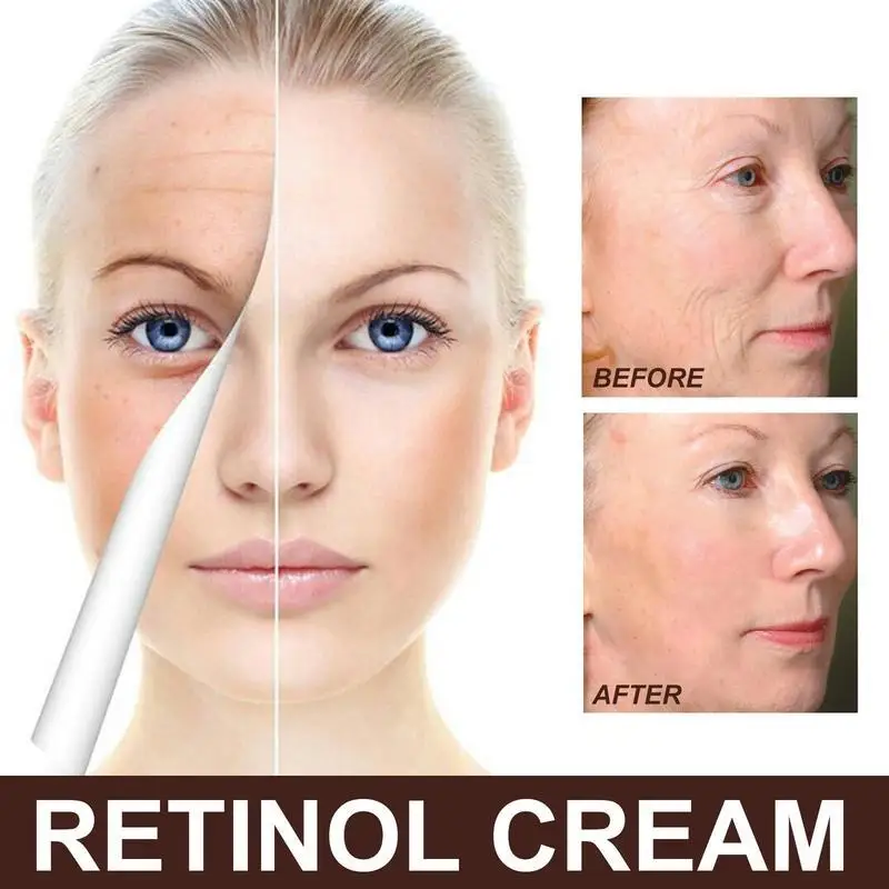 Crema al retinolo crema antirughe Anti invecchiamento Lifting Fade Fine Line crema viso idratante nutriente cura della pelle