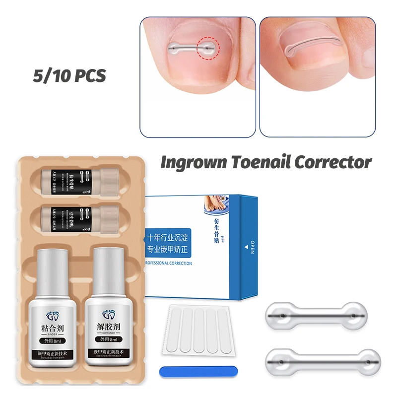 【Ingrown Toenail Corrector Tools Pedicure Recover Embed Toe Nail Professional I…