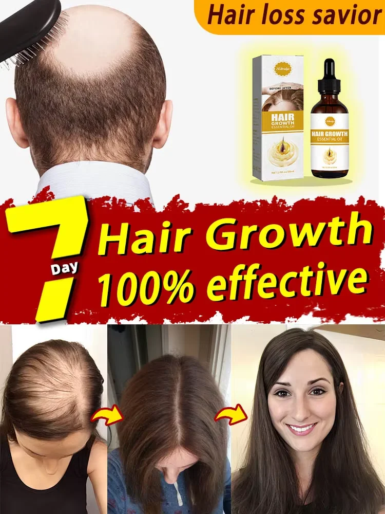 The best-selling hair growth product in Asia. From today, you will no longer be troubled by hair loss and baldness. Find your be