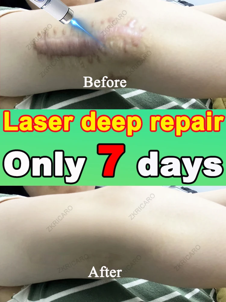 Sᴋɪɴ ʙᴇᴄᴏᴍᴇs sᴍᴏᴏᴛʜ ᴀɴᴅ sᴄᴀʀ-ғʀᴇᴇ