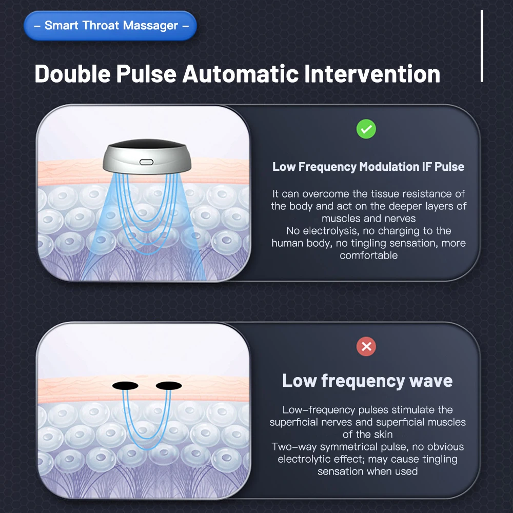 Slimme Anti-Snurk Apparaat Ademhaling Corrector Elektrische Anti Snurk Slaap Pro Smart Ems Anti Snurk Apparaat