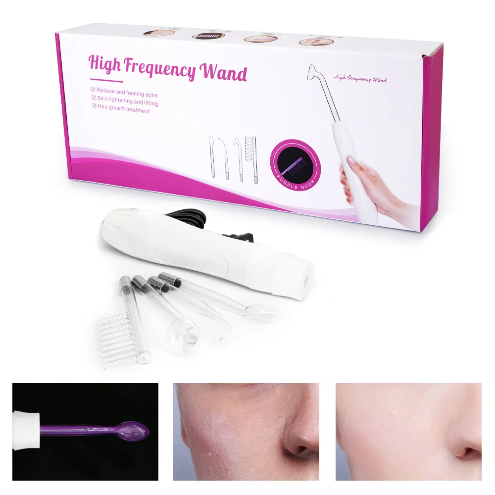 

Высокочастотный аппарат для удаления пятен на коже, портативный косметический инфракрасный фиолетовый аппарат