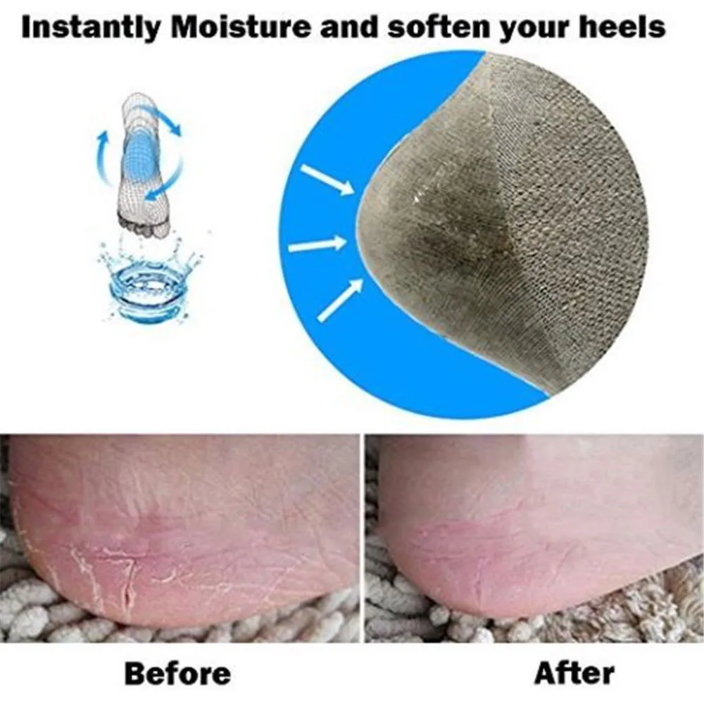 Meias pés almofadas para calcanhar calcanhar gel protetor palmilhas absorventes de choque cuidados com os pés almofada de reparação da pele anti-rachadura pé meia 2 pçs