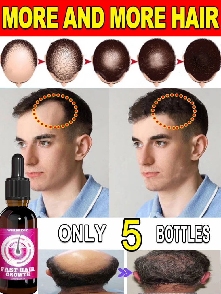 

98% of customers repurchase, have more and more hair, say goodbye to baldness