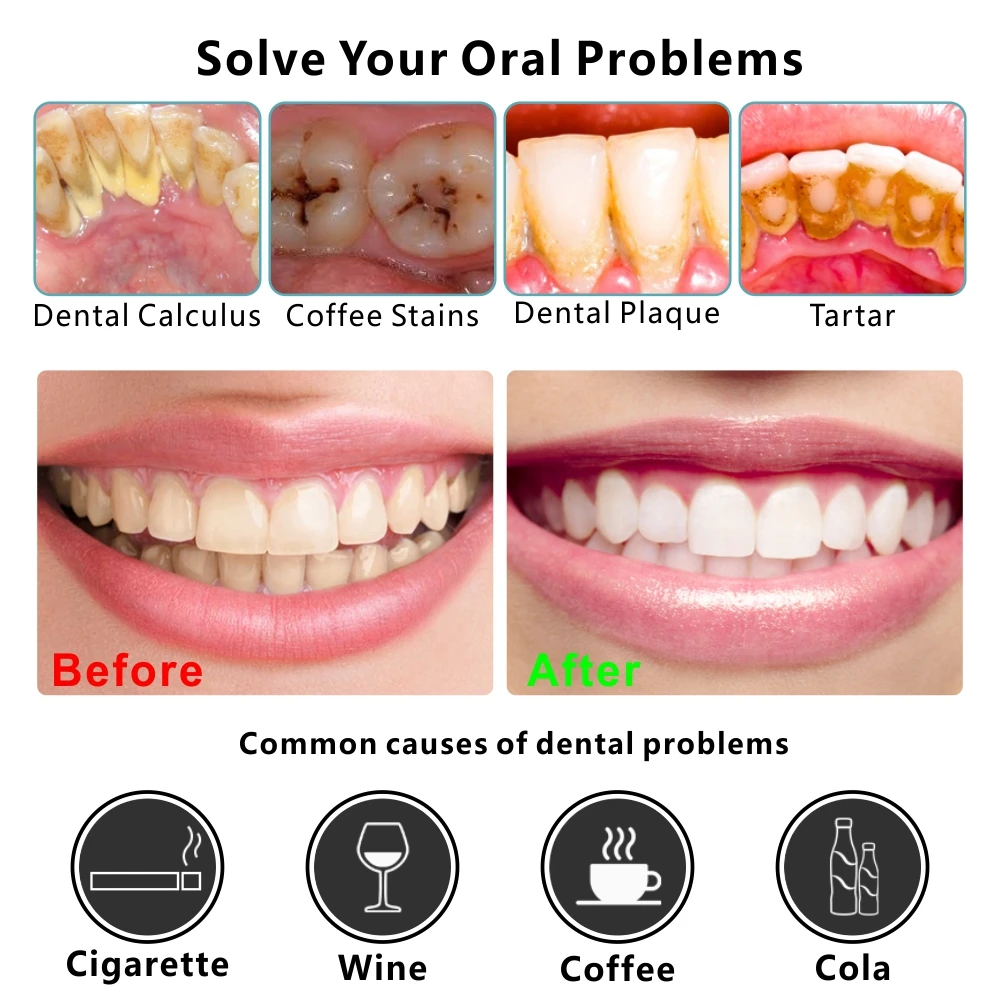 Làm Sạch Răng Bộ Dụng Cụ Gương Nhíp Cuốc Đầu Đo Cói Máy Miệng Nha Khoa Chăm Sóc Inox Cao Răng Loại Bỏ Nha Khoa Dụng Cụ