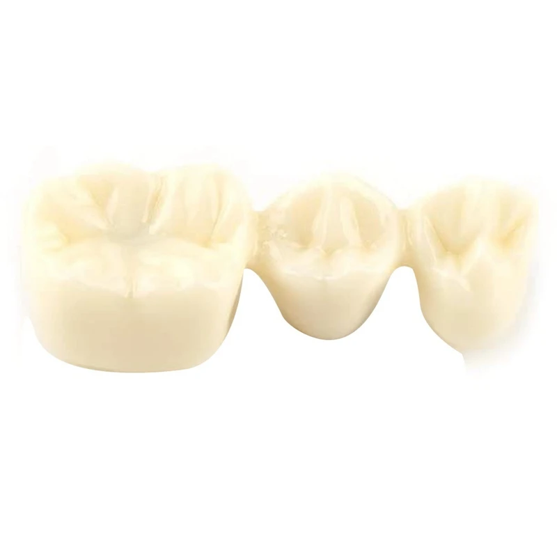 Teeth Demonstration Model Implant Removable Analysis Crown Bridge For -Patient Communication