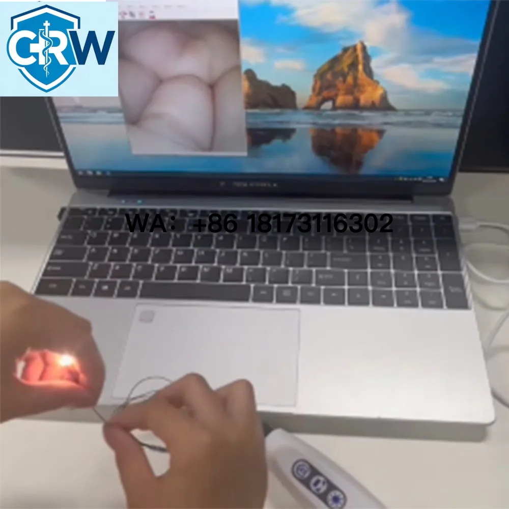 CRW 1.5mm OVM6946 Micro    400x400P USB  Medical Module for Laptop PC Diagnose Disposable Waterproof
