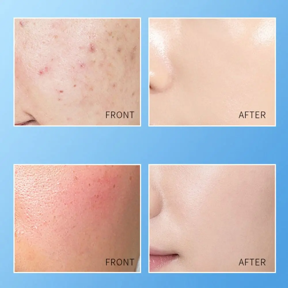 Novo 80g creme hidratante facial branco calmante & efeito hidratante creme facial calmante hidratante b5 creme clareador acne