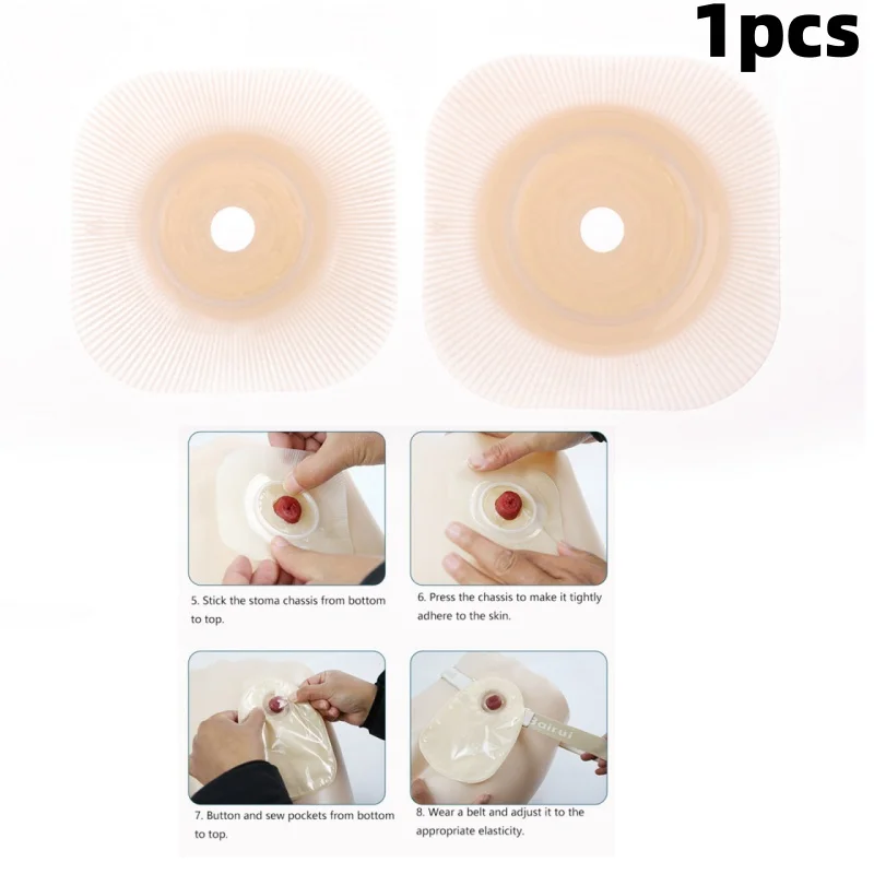 1Pcs Colostomy Bags Baseplates Hydrocolloid Stoma Care Durable Skin Barriers Ostomy Bags Plates