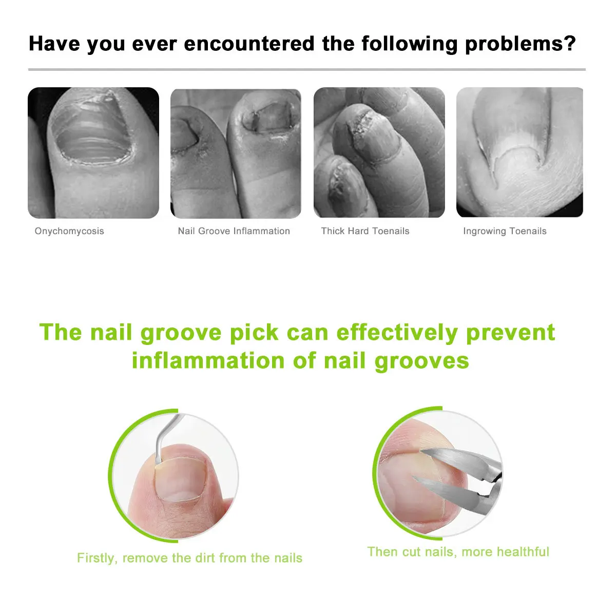 

1Set Nail Clippers Set Stainless Steel Sharp Toenails Fingernails Grooming Kit Portable Ergonomic Travel Home Use