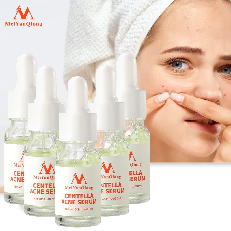 5 pcs MeiYanQiong Centella Essence Quickly And Effectively Removes The Moisturizing And Dryness Of Blackheads And Whitening Skin