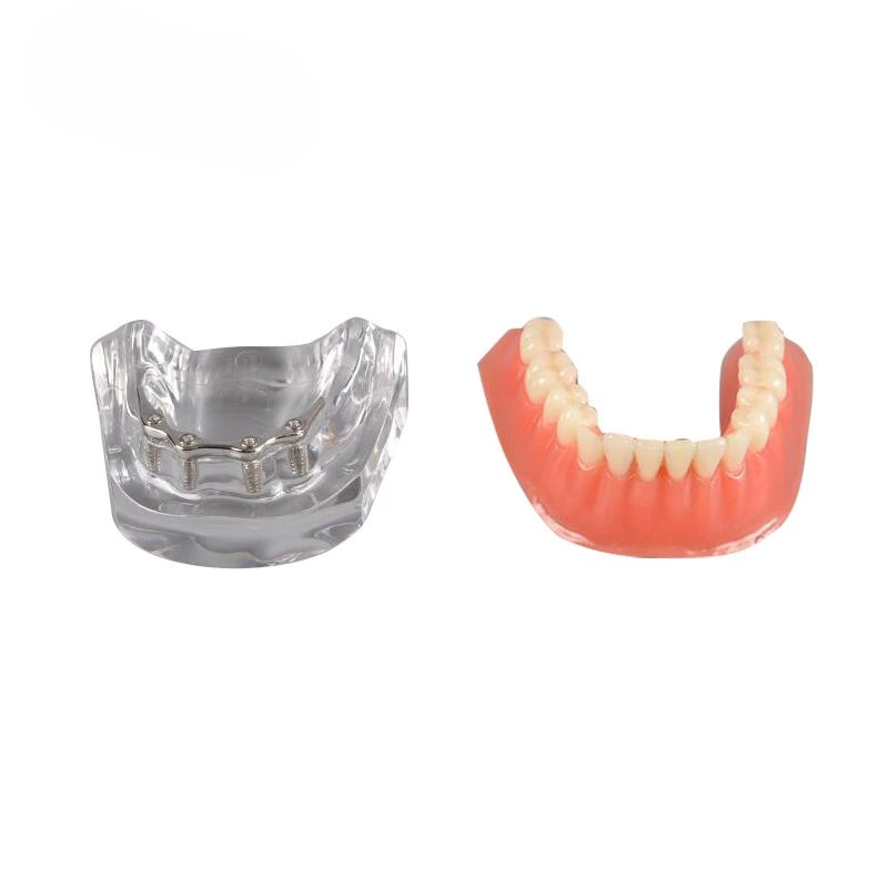 Full Mouth Elderly Tooth Model Display Activity Supplies Removable Dentures