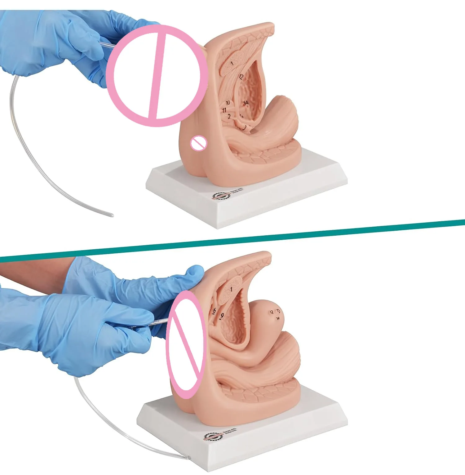 Ultrassist External Genital Anatomy Model Set Male & Female Catheterization Insertion Trainer for Medical Student Education Demo
