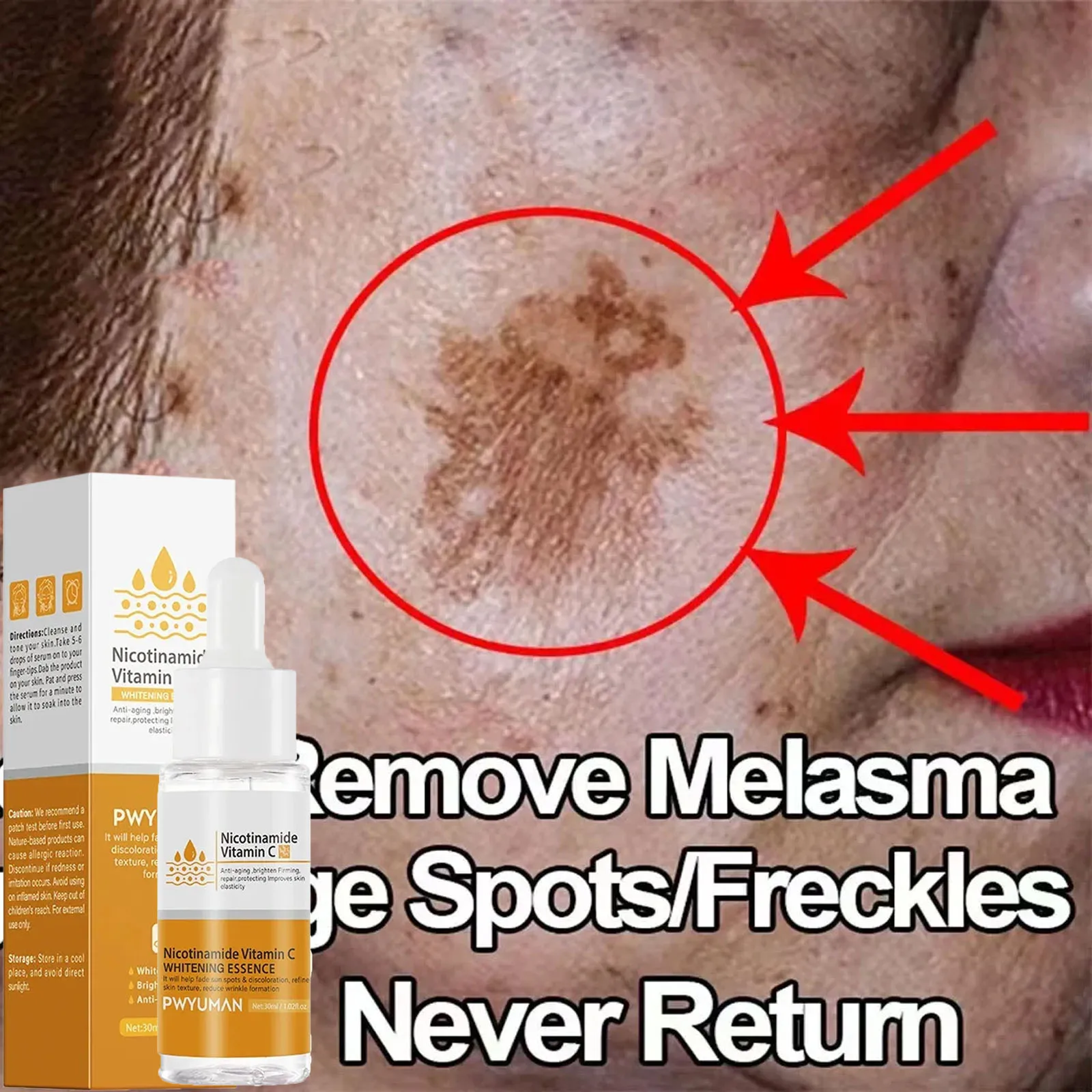 Vitamin C Whitening Freckles Face Serum Niacinamide Fade Fines Lines Removal Melasma Dark Spots Brightening Anti-aging Skin Care