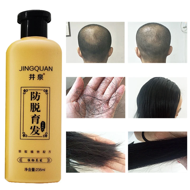 Hair Growth Shampoo Anti Hair Loss Thick Black Anti-Dandruff Antipruritic Refreshing Oil Control Ginger Nourish Hair Care 235ml