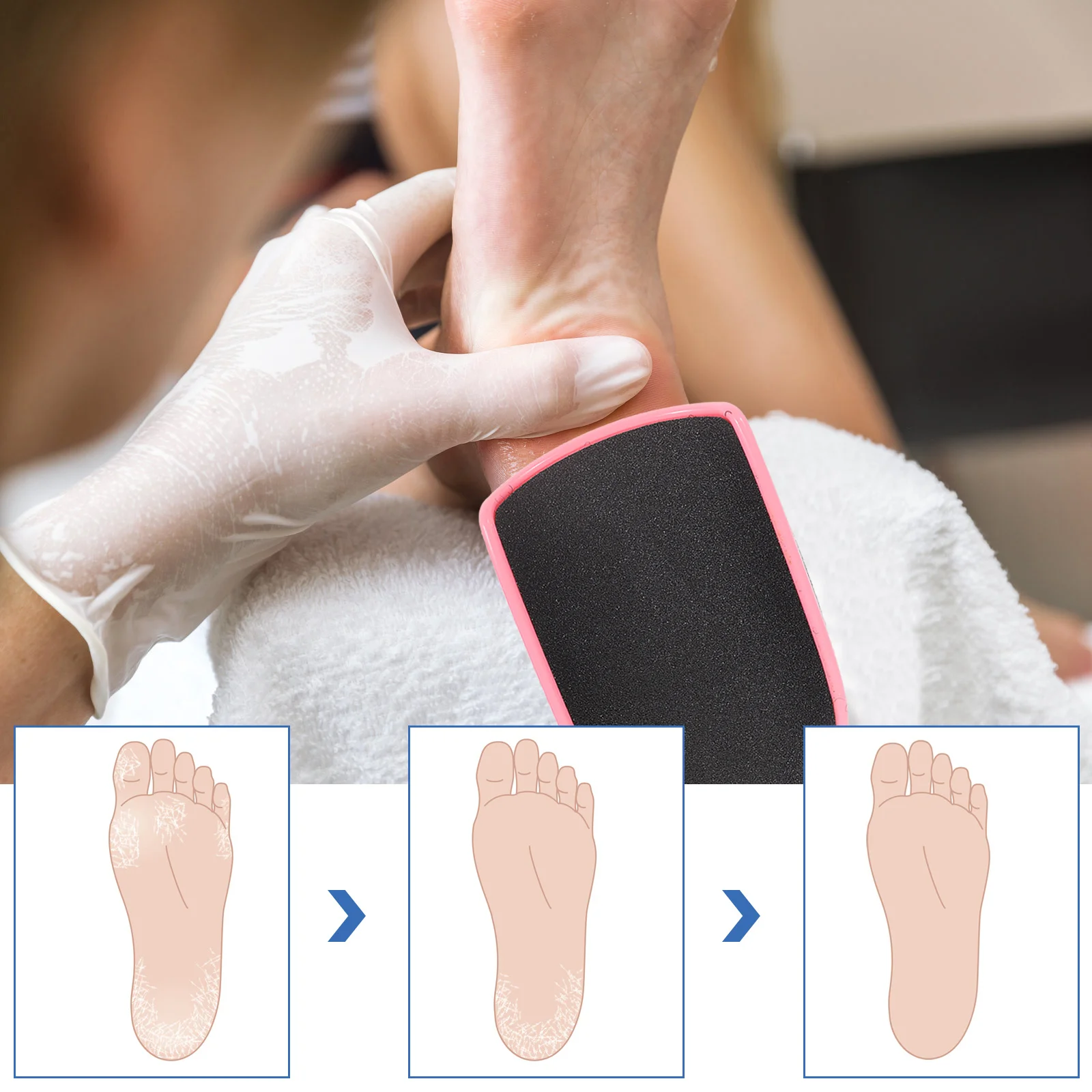 

2Pcs Foot Callus Remover Double-Sided Pedicure File Durable Dead Skin Remover Ergonomic Handle Home Use Pedicure File