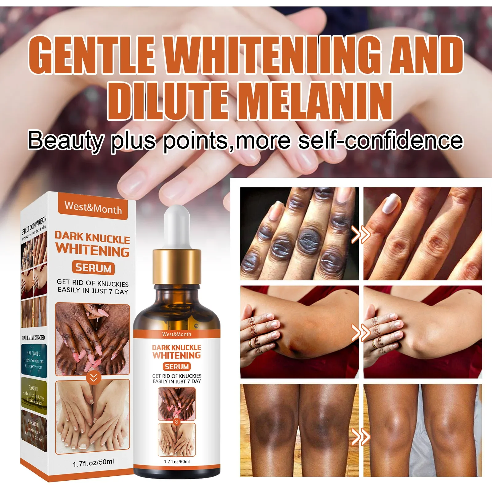 

Get Glowing Skin with West&Month Joint Whitening and Melanin Removal Body Care Set with Knee, Ankle, and Elbow Melanin Remover