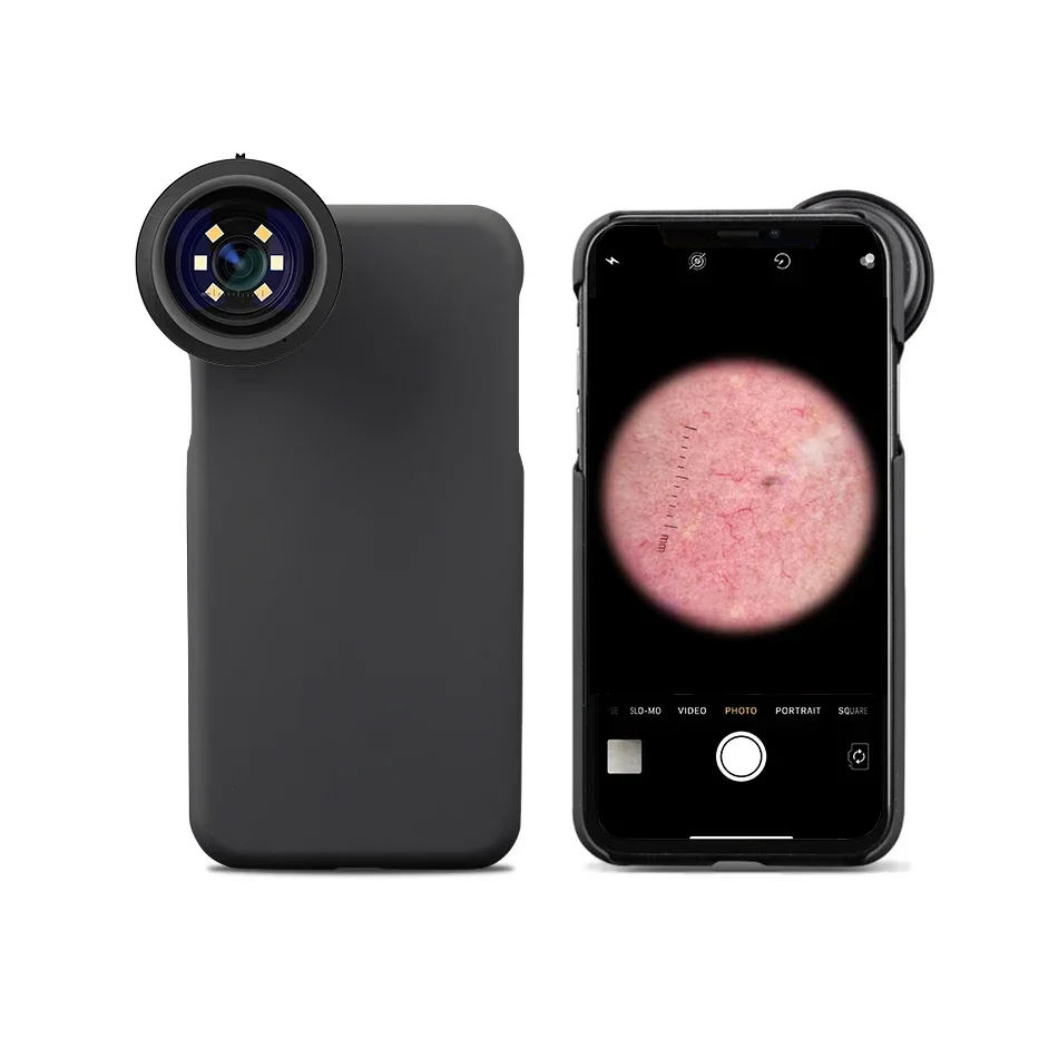

IBOOLO DE-300 Polarized Skin Analyzer Scope Machine, Mobile Phone Dermatoscope