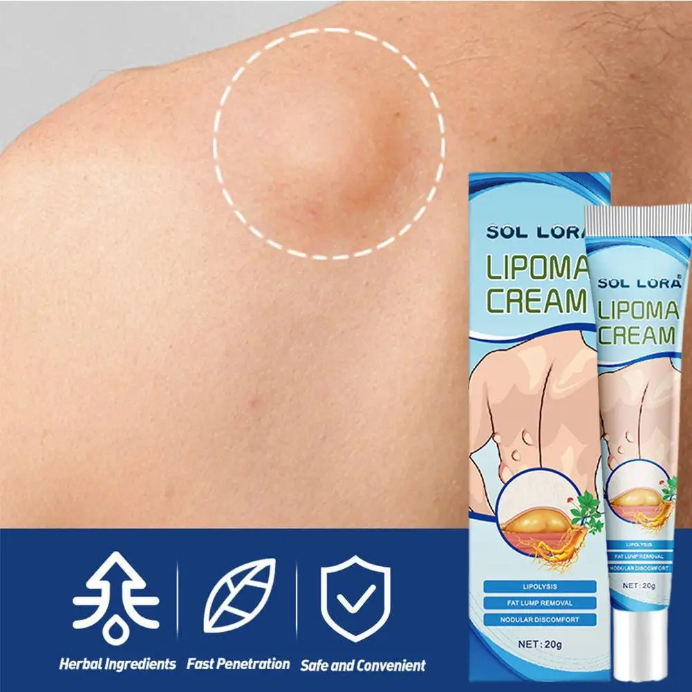 Lipom entfernungs creme Lipolyse Fett klumpen entlastung Gips Haut Schwellung Fettabbau Creme Tropfen Versand 20g Gesundheits wesen